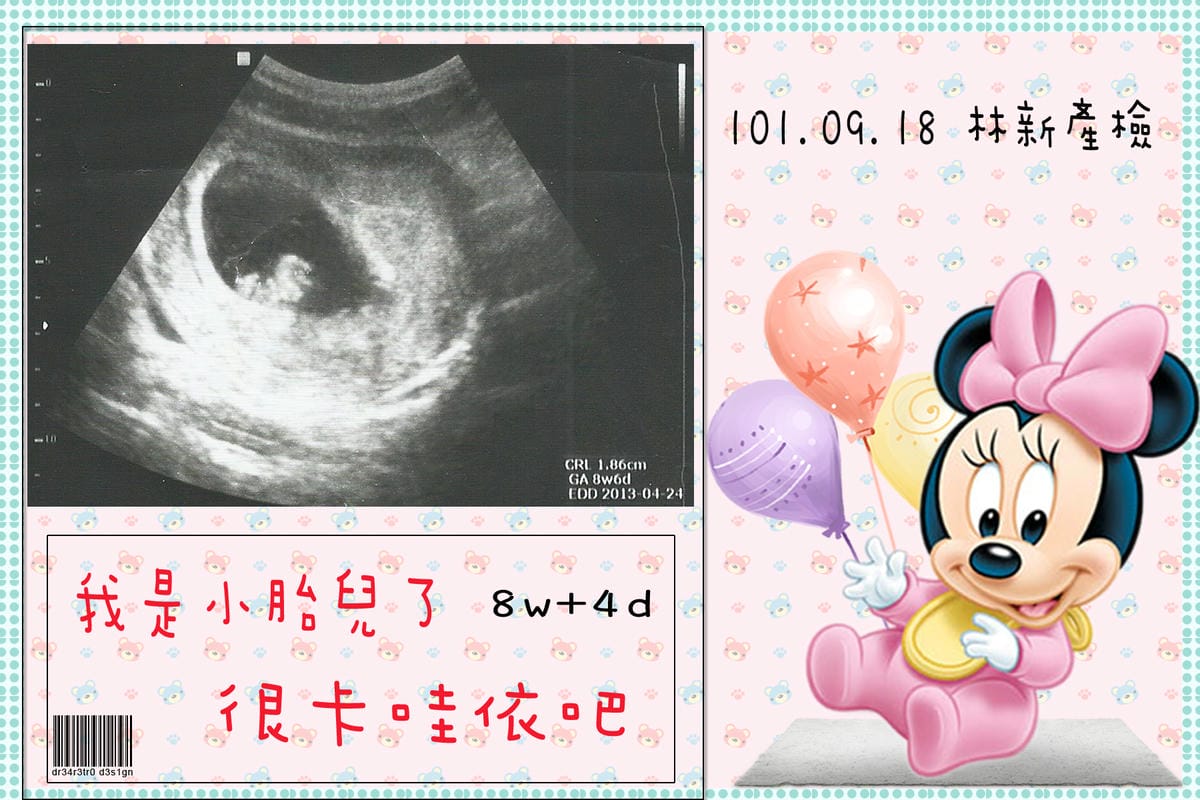 8+4拷貝