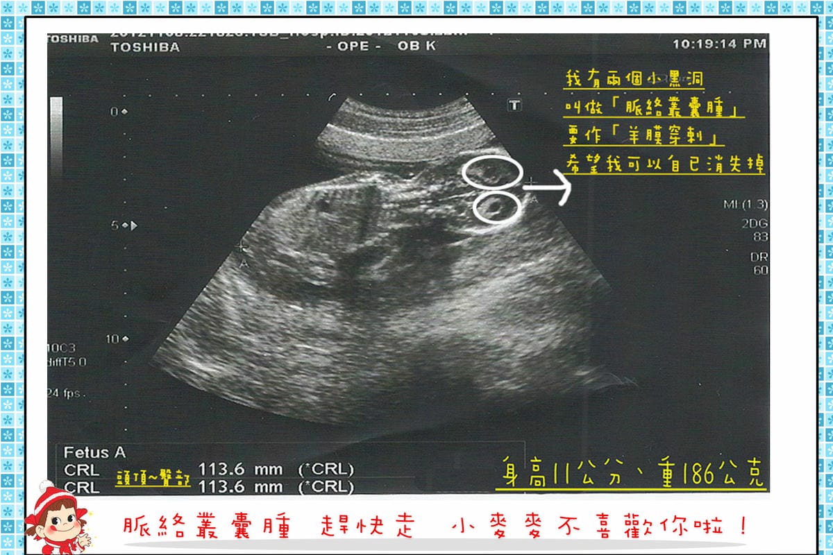 15+6拷貝